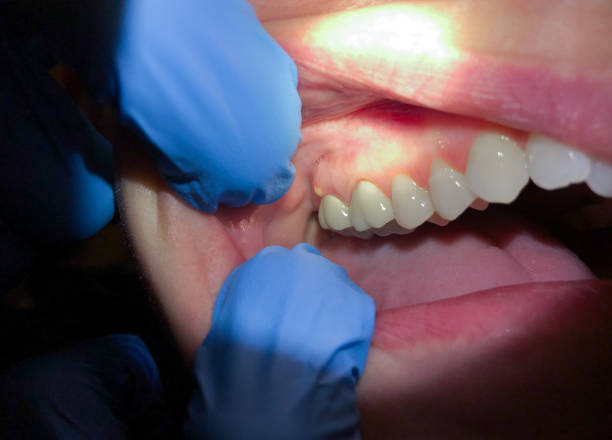 Best Pediatric Emergency Dentist in Colstrip, MT